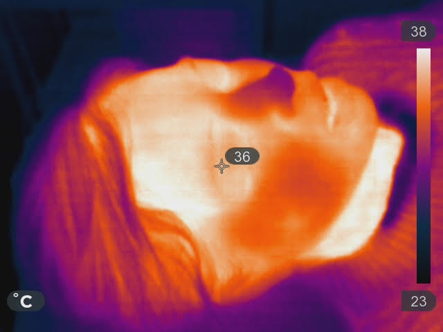 Thermal Lifting and tightening treatment