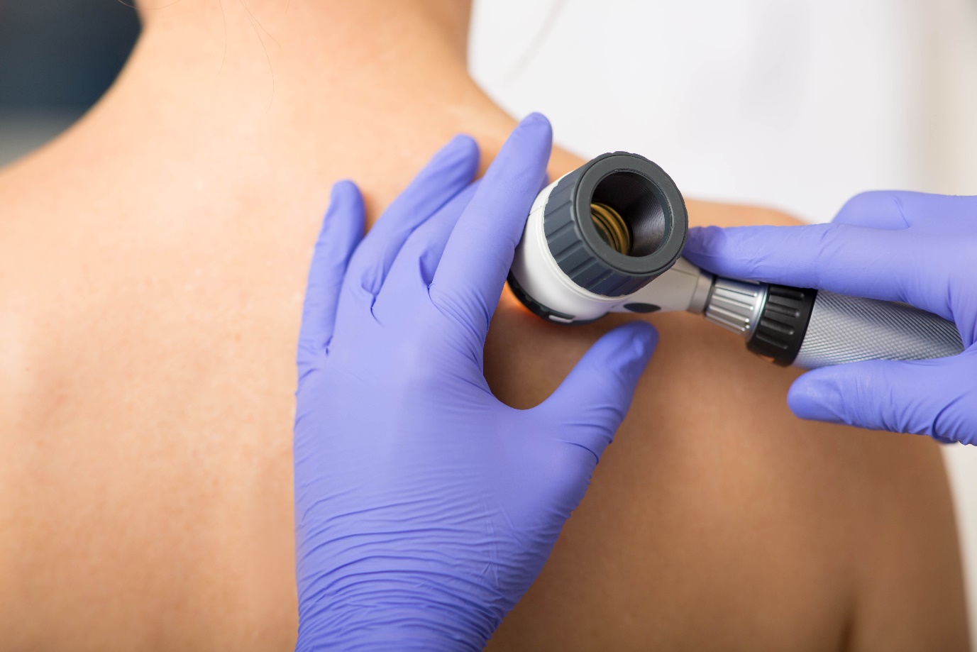 skin Skin cancer examination